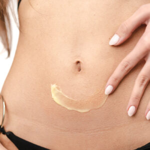 Before & After - immagine 3